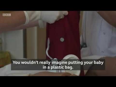 The world&#039;s first artificial womb for humans