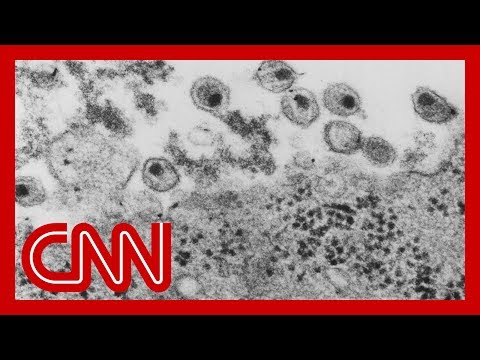 First new HIV strain discovered in nearly two decades
