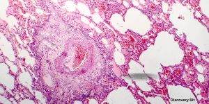 medical breakthroughs, breakthrough in medical science, latest medical discoveries, latest medical breakthroughs