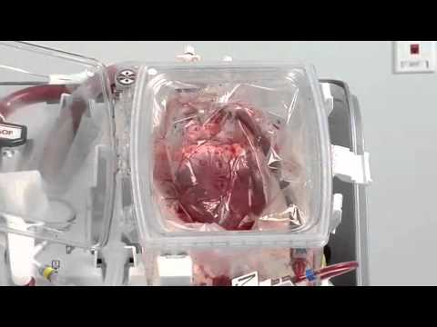 The Organ Care System - human donor hearts