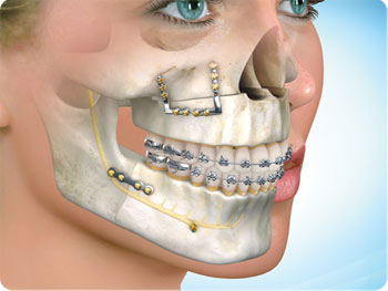 Oral аnd Mаxillоfасiаl Surgеоn, Jobs, USA