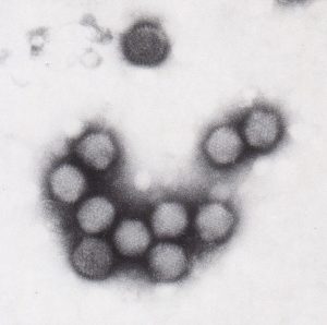 Vaccinia virus, Adenoviruses, Maraba virus, Reovirus, Measles, Herpes simplex, Murine norovirus, Enterovirus, Zika virus, HIV virus, virus, Health, medical uses, science